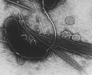 Ein Cholerabakterium unter dem Elektronenmikroskop