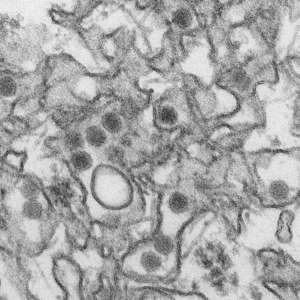 Zika-Virus Elektronenmikroskop